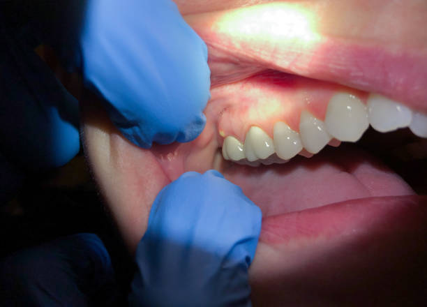 Best Teeth Whitening  in Kensington Park, FL